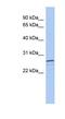 V-Set And Transmembrane Domain Containing 2A antibody, NBP1-79604, Novus Biologicals, Western Blot image 