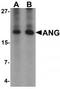 Angiogenin antibody, TA319609, Origene, Western Blot image 