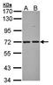 Protein O-Linked Mannose N-Acetylglucosaminyltransferase 1 (Beta 1,2-) antibody, orb69889, Biorbyt, Western Blot image 