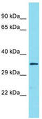 Uncharacterized protein C9orf66 antibody, TA334798, Origene, Western Blot image 