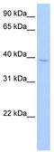 Serum Response Factor Binding Protein 1 antibody, TA339807, Origene, Western Blot image 