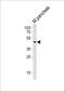 Pancreas/duodenum homeobox protein 1 antibody, A00491-2, Boster Biological Technology, Western Blot image 