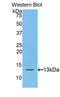 Hepcidin Antimicrobial Peptide antibody, LS-C294483, Lifespan Biosciences, Western Blot image 