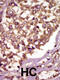 BMX Non-Receptor Tyrosine Kinase antibody, 63-157, ProSci, Immunohistochemistry paraffin image 