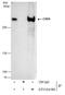 Chromodomain Helicase DNA Binding Protein 4 antibody, GTX124186, GeneTex, Immunoprecipitation image 