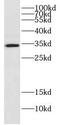 DnaJ Heat Shock Protein Family (Hsp40) Member C9 antibody, FNab02470, FineTest, Western Blot image 