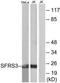 Serine And Arginine Rich Splicing Factor 3 antibody, TA314521, Origene, Western Blot image 