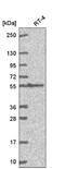 Gamma-Glutamyltransferase 1 antibody, NBP2-56998, Novus Biologicals, Western Blot image 