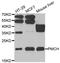 Pro-Melanin Concentrating Hormone antibody, abx005132, Abbexa, Western Blot image 