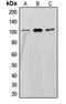 Staphylococcal Nuclease And Tudor Domain Containing 1 antibody, orb215129, Biorbyt, Western Blot image 