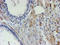 Migration And Invasion Enhancer 1 antibody, LS-C336891, Lifespan Biosciences, Immunohistochemistry paraffin image 