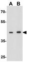 DEP domain-containing mTOR-interacting protein antibody, GTX31575, GeneTex, Western Blot image 