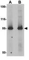 LRR Binding FLII Interacting Protein 2 antibody, GTX31429, GeneTex, Western Blot image 