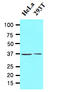 Laforin antibody, AM09050PU-S, Origene, Western Blot image 