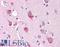 ARHGEF28 antibody, LS-B15874, Lifespan Biosciences, Immunohistochemistry paraffin image 