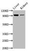 Dimethylglycine dehydrogenase, mitochondrial antibody, CSB-PA883415LA01HU, Cusabio, Western Blot image 