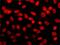 Histone Deacetylase 2 antibody, GTX12169, GeneTex, Immunocytochemistry image 
