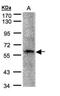 PML-RARA Regulated Adaptor Molecule 1 antibody, NBP1-31075, Novus Biologicals, Western Blot image 