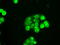 Solute Carrier Family 2 Member 5 antibody, LS-C799266, Lifespan Biosciences, Immunofluorescence image 