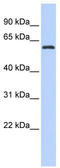 AT-Rich Interaction Domain 3A antibody, TA343519, Origene, Western Blot image 