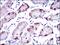 Bile acyl-CoA synthetase antibody, GTX60693, GeneTex, Immunohistochemistry paraffin image 