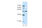 Neuromedin U Receptor 2 antibody, 28-267, ProSci, Enzyme Linked Immunosorbent Assay image 