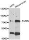 Furin, Paired Basic Amino Acid Cleaving Enzyme antibody, LS-C748390, Lifespan Biosciences, Western Blot image 