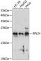 Ribosomal Protein L24 antibody, A07251, Boster Biological Technology, Western Blot image 
