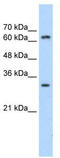 PID antibody, TA343483, Origene, Western Blot image 