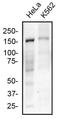 FA Complementation Group D2 antibody, NBP2-54808, Novus Biologicals, Western Blot image 