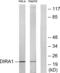 DIRAS Family GTPase 1 antibody, abx014512, Abbexa, Western Blot image 