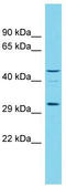 2-Oxoglutarate And Iron Dependent Oxygenase Domain Containing 3 antibody, TA338666, Origene, Western Blot image 