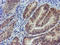 Myeloid leukemia factor 2 antibody, LS-C174001, Lifespan Biosciences, Immunohistochemistry paraffin image 
