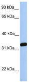 NFKB Inhibitor Interacting Ras Like 2 antibody, TA336205, Origene, Western Blot image 