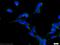 Hook Microtubule Tethering Protein 1 antibody, 10871-1-AP, Proteintech Group, Immunofluorescence image 