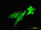 Tumor Susceptibility 101 antibody, LS-B5547, Lifespan Biosciences, Immunofluorescence image 