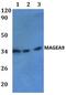 Melanoma-associated antigen 9 antibody, GTX66873, GeneTex, Western Blot image 