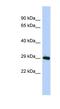 Zinc Finger Protein 524 antibody, NBP1-80423, Novus Biologicals, Western Blot image 