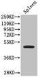 Sst2 antibody, CSB-PA022725LA01HU, Cusabio, Western Blot image 