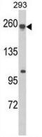 ABCC5 antibody, GTX81163, GeneTex, Western Blot image 
