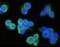 Epithelial Cell Adhesion Molecule antibody, 10694-R028, Sino Biological, Immunohistochemistry frozen image 