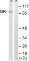 Glucocorticoid receptor antibody, TA313369, Origene, Western Blot image 
