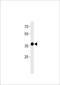 Matrix AAA Peptidase Interacting Protein 1 antibody, TA325157, Origene, Western Blot image 