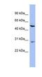 Keratin 75 antibody, NBP1-55236, Novus Biologicals, Western Blot image 
