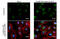 Microtubule Associated Protein 1 Light Chain 3 Beta antibody, GTX127375, GeneTex, Immunocytochemistry image 