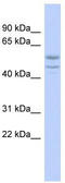 Spermatogenesis And Oogenesis Specific Basic Helix-Loop-Helix 2 antibody, TA345228, Origene, Western Blot image 