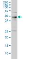 PHD Finger Protein 1 antibody, H00005252-M01, Novus Biologicals, Western Blot image 
