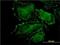 Rho-related GTP-binding protein RhoJ antibody, H00057381-M01, Novus Biologicals, Immunofluorescence image 