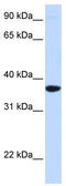 Secretagogin, EF-Hand Calcium Binding Protein antibody, TA346447, Origene, Western Blot image 