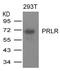 PRL-R antibody, GTX50723, GeneTex, Western Blot image 